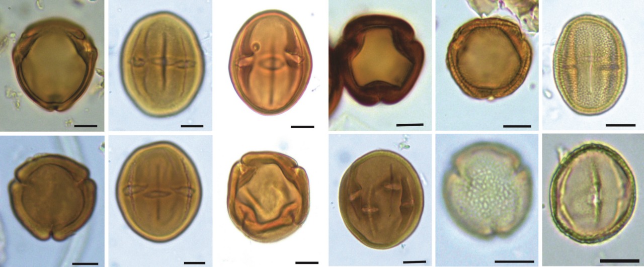Grãos de pólen de espécies da família Salicaceae. Foto Silva, HMS. Escala em 10 µm